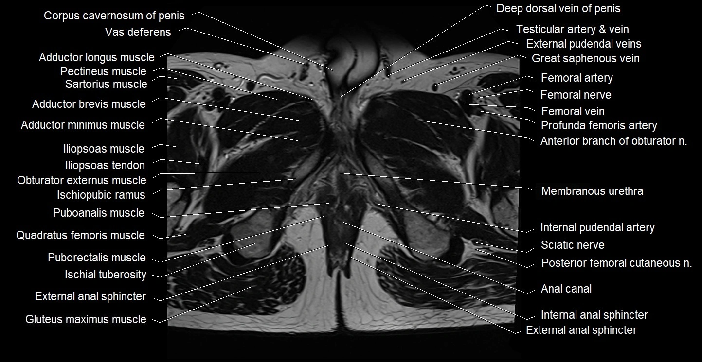 Male pelvis axial cross sectional anatomy image 41.webp